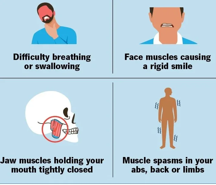Infographic detailing symptoms: breathing/swallowing difficulty, facial muscle rigidity, lockjaw, and muscle spasms in the body.
