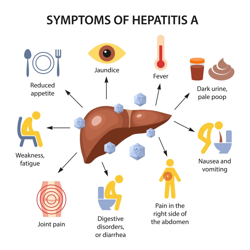 Medical illustration of a liver surrounded by icons showing symptoms of Hepatitis A such as fatigue, joint pain, digestive issues, abdominal pain, nausea, dark urine, fever, and jaundice.